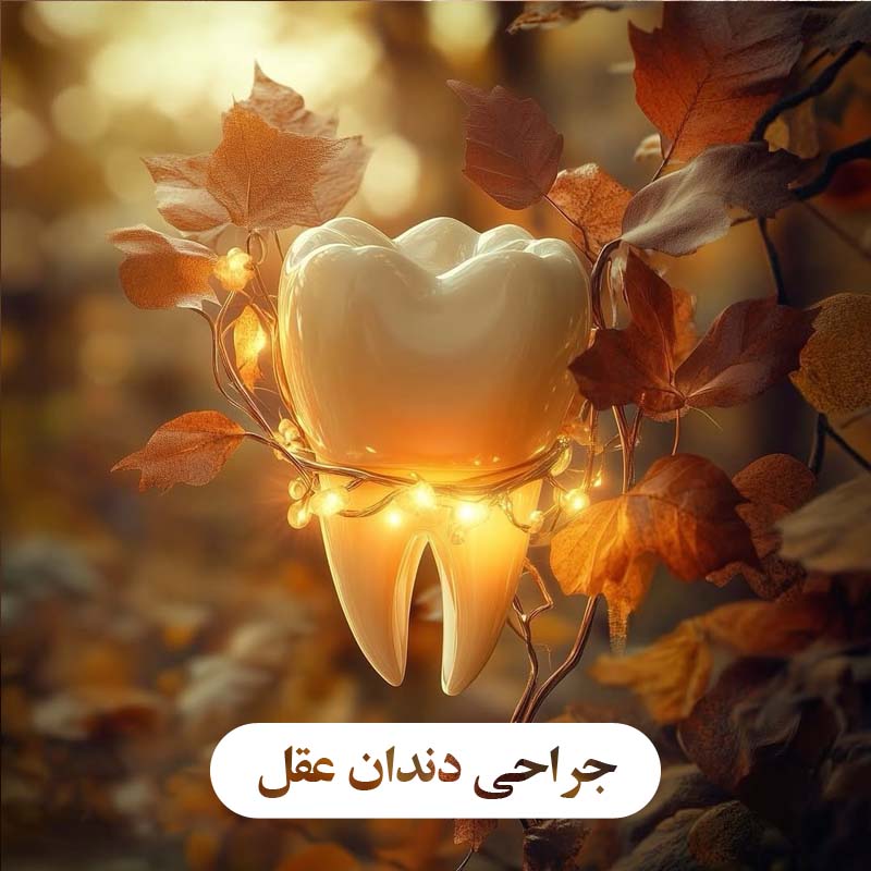 جراحی دندان عقل